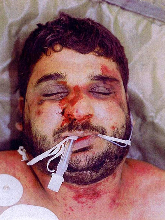 Baha Mousa, an Iraqi civilian tortured to death while in British Army custody in Basra, Iraq in September 2003