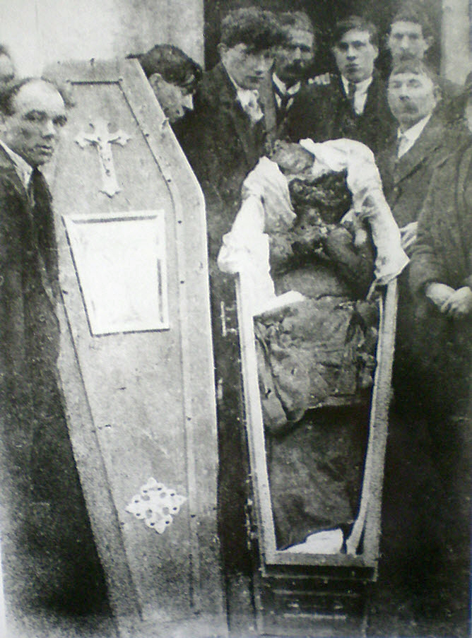 The mutilated body of Patrick Loughnane, age 29, Volunteer of the Irish Republican Army, tortured to death alongside his younger brother Harry, age 22, by the Royal Irish Constabulary, Britain's feared colonial police force in Ireland, 1920